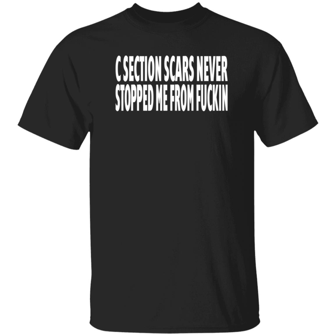 C Section Scars Never Stopped Me From Fuckin Shirt Hoodie Sweatshirt - Teechipus