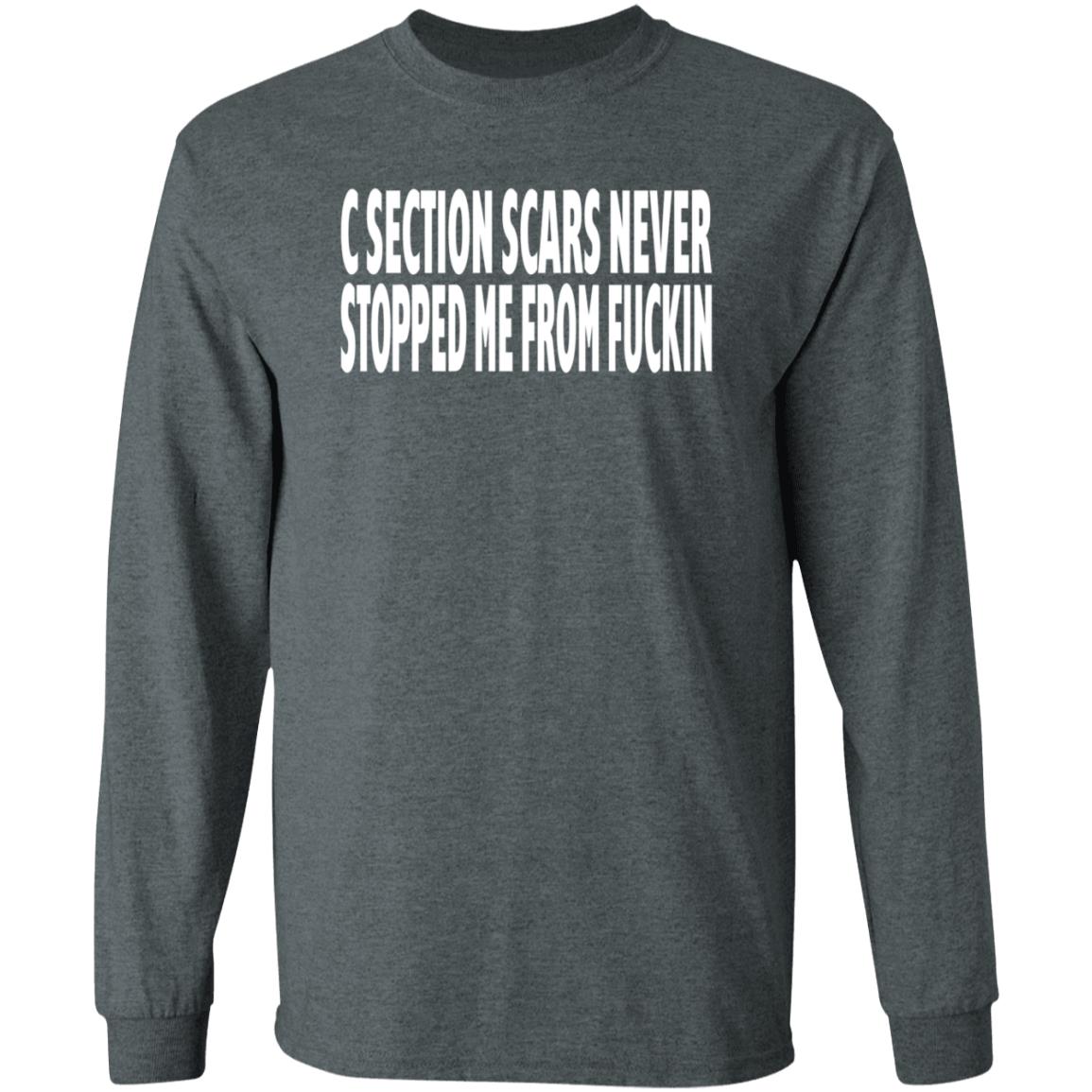 C Section Scars Never Stopped Me From Fuckin Shirt Hoodie Sweatshirt - Teechipus
