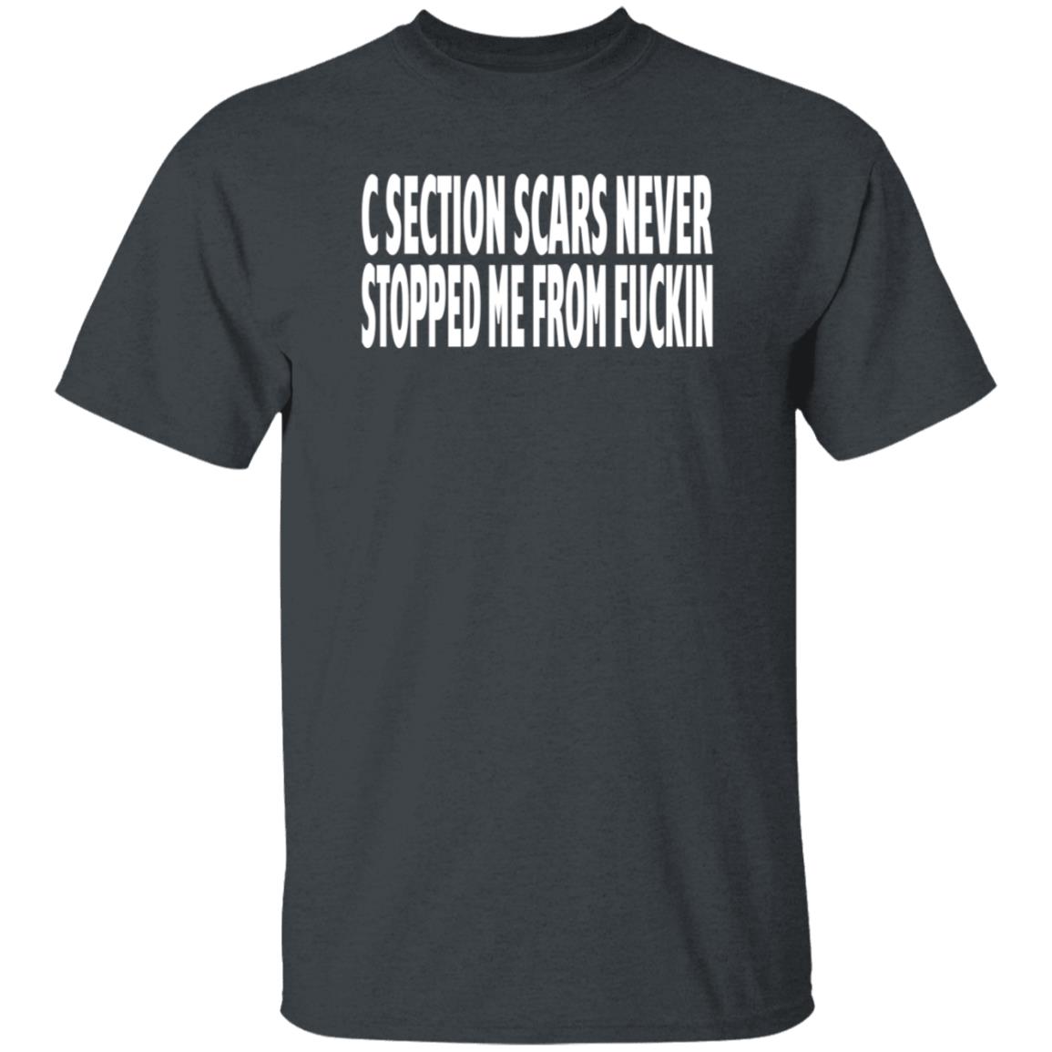 C Section Scars Never Stopped Me From Fuckin Shirt Hoodie Sweatshirt - Teechipus