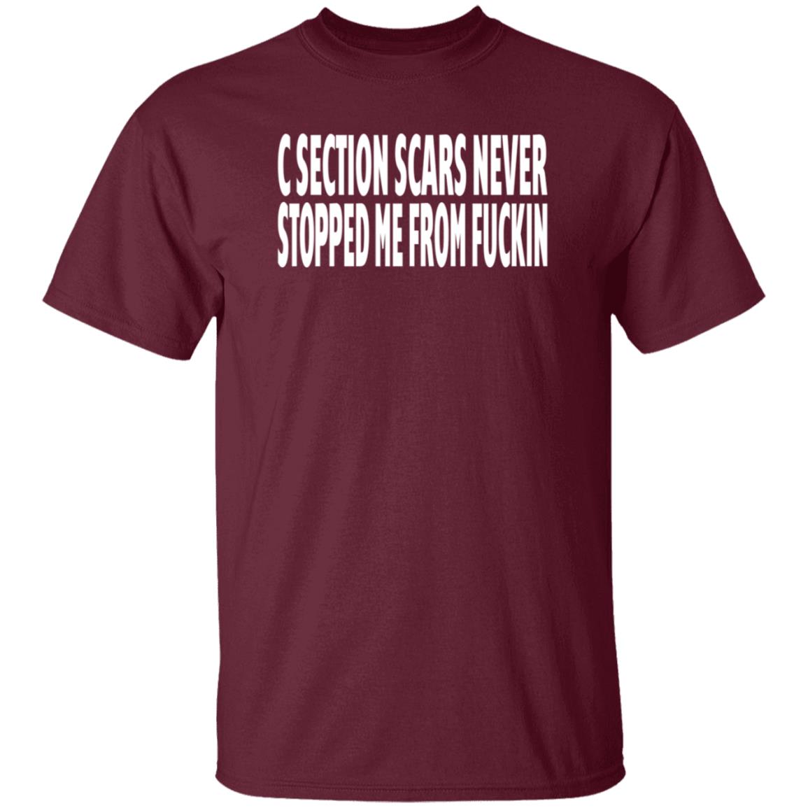 C Section Scars Never Stopped Me From Fuckin Shirt Hoodie Sweatshirt - Teechipus