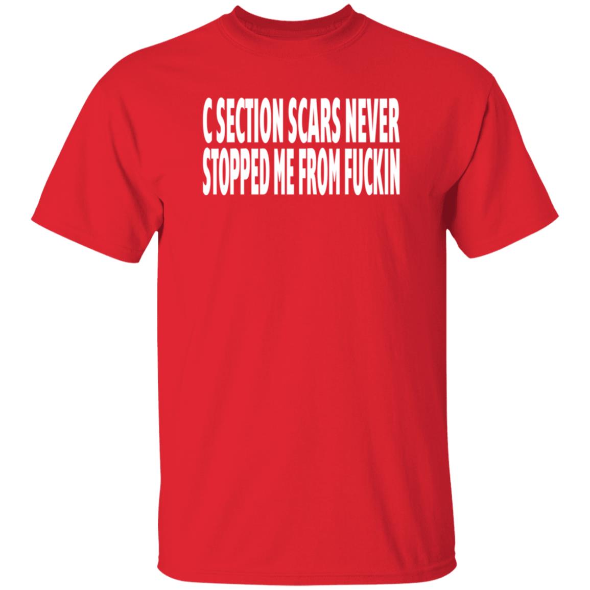 C Section Scars Never Stopped Me From Fuckin Shirt Hoodie Sweatshirt - Teechipus