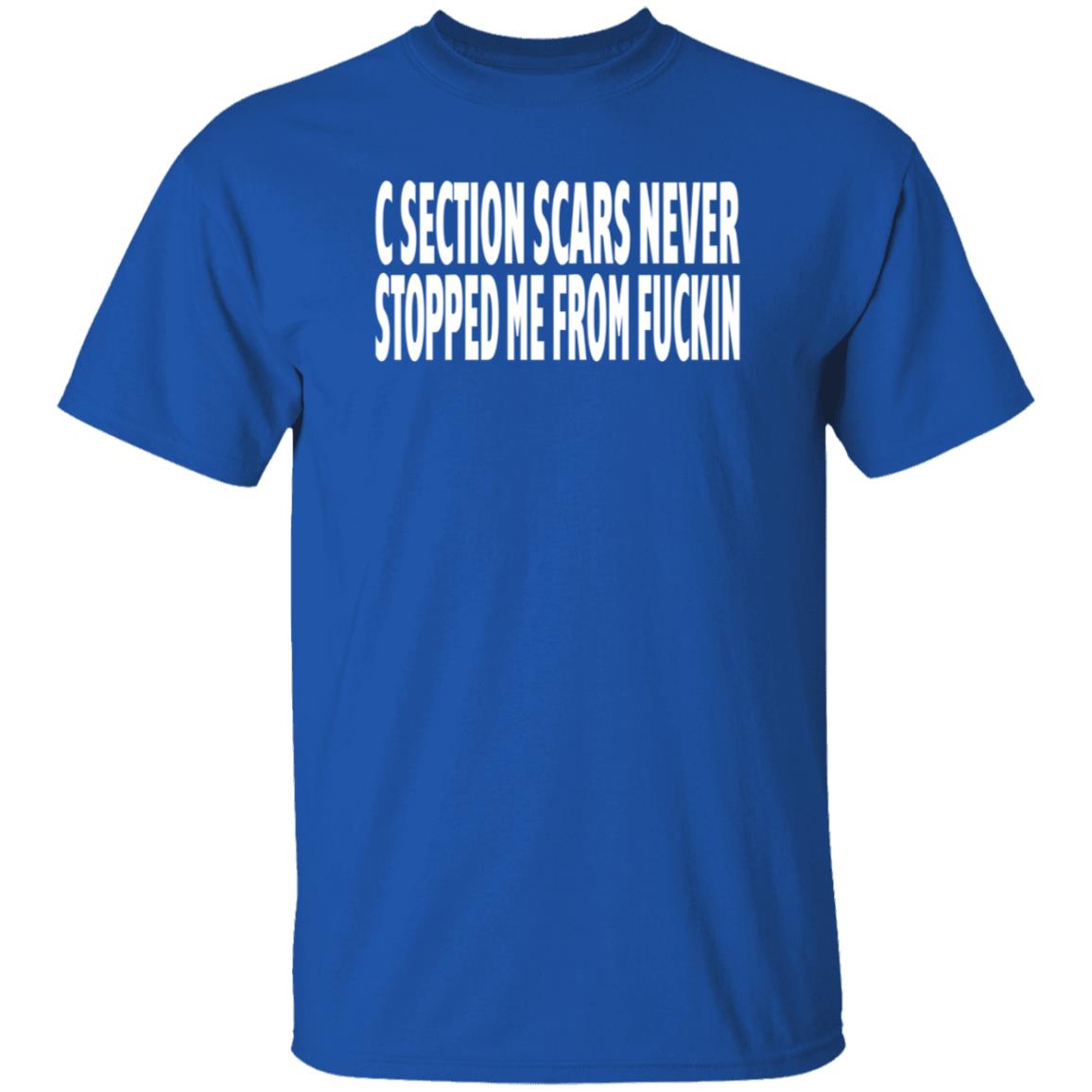C Section Scars Never Stopped Me From Fuckin Shirt Hoodie Sweatshirt - Teechipus