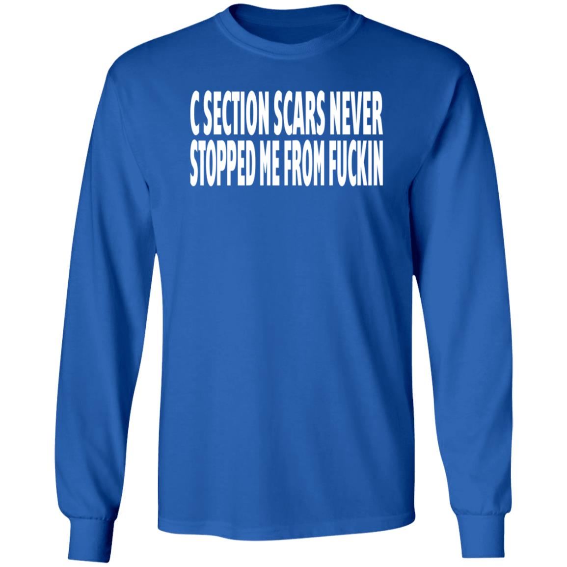 C Section Scars Never Stopped Me From Fuckin Shirt Hoodie Sweatshirt - Teechipus