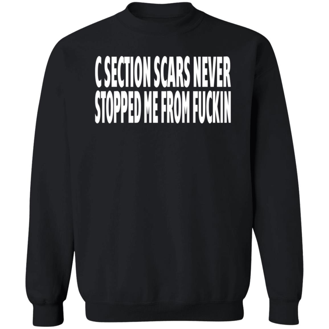 C Section Scars Never Stopped Me From Fuckin Shirt Hoodie Sweatshirt - Teechipus