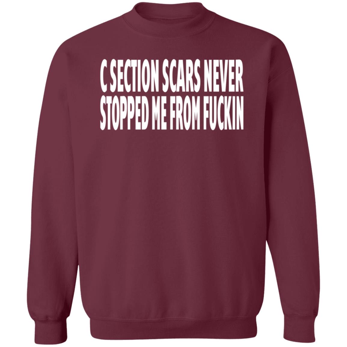 C Section Scars Never Stopped Me From Fuckin Shirt Hoodie Sweatshirt - Teechipus