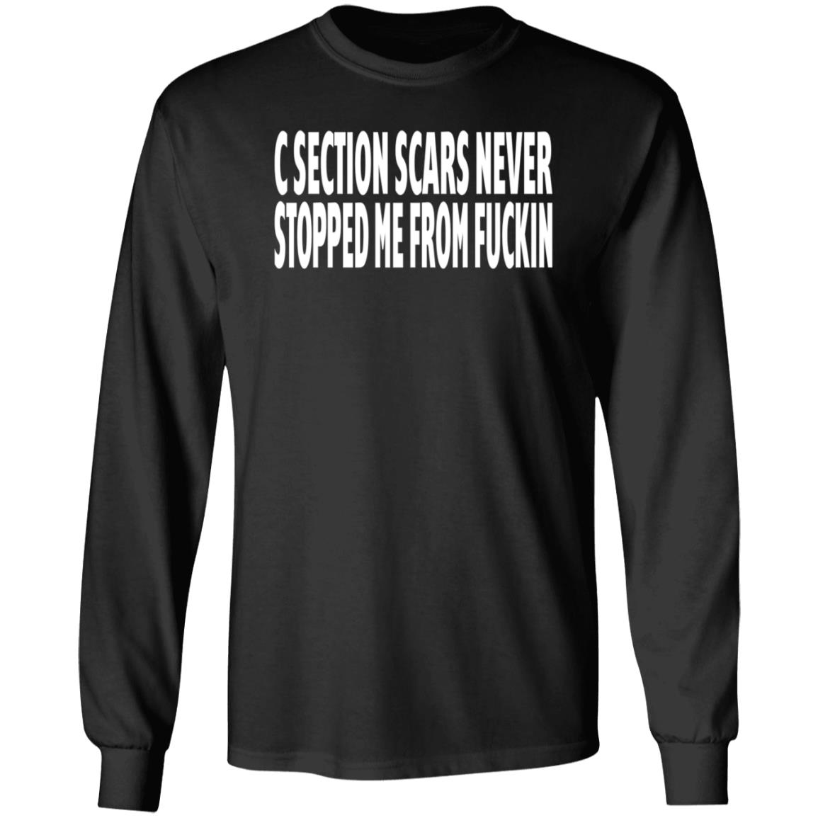 C Section Scars Never Stopped Me From Fuckin Shirt Hoodie Sweatshirt - Teechipus