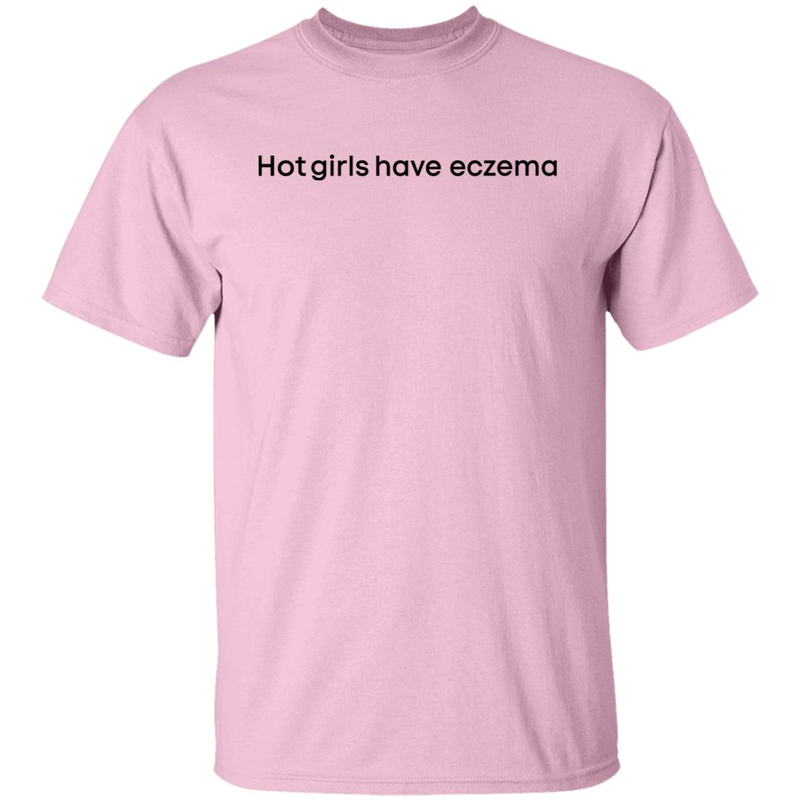 Hot Girls Have Eczema Shirt Nina Juffermans Hot Girls Have Eczema Shirt Hoodie Sweatshirt